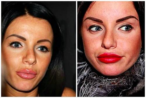 Юлия волкова до и после пластики, как выглядит певица сейчас, последние фото
