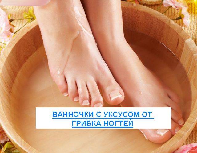 Ванночки для ног от грибка в домашних условиях: эффективные рецепты на основе народных средств | mfarma.ru