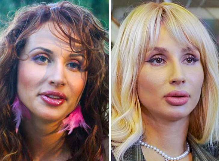 Российские актрисы до и после пластики фото