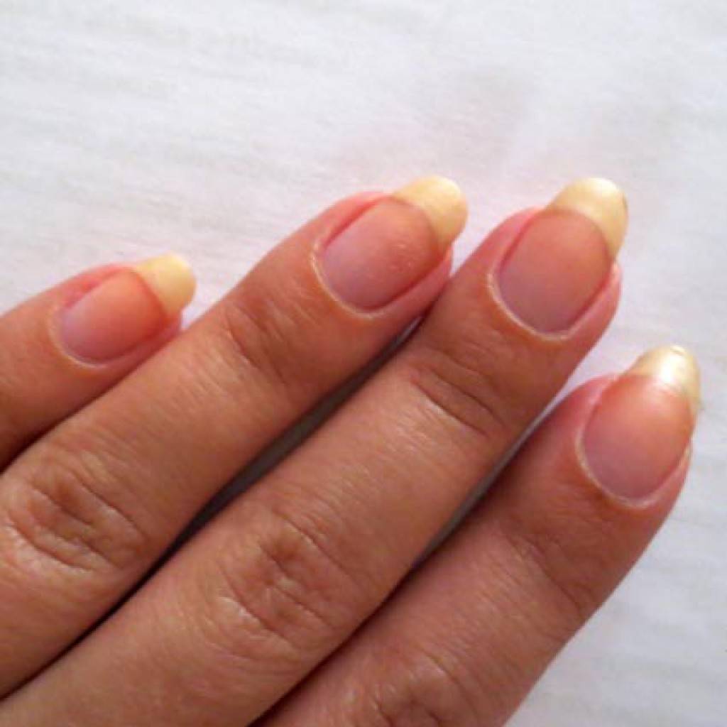 Причины пожелтения ногтей | блог pilochka