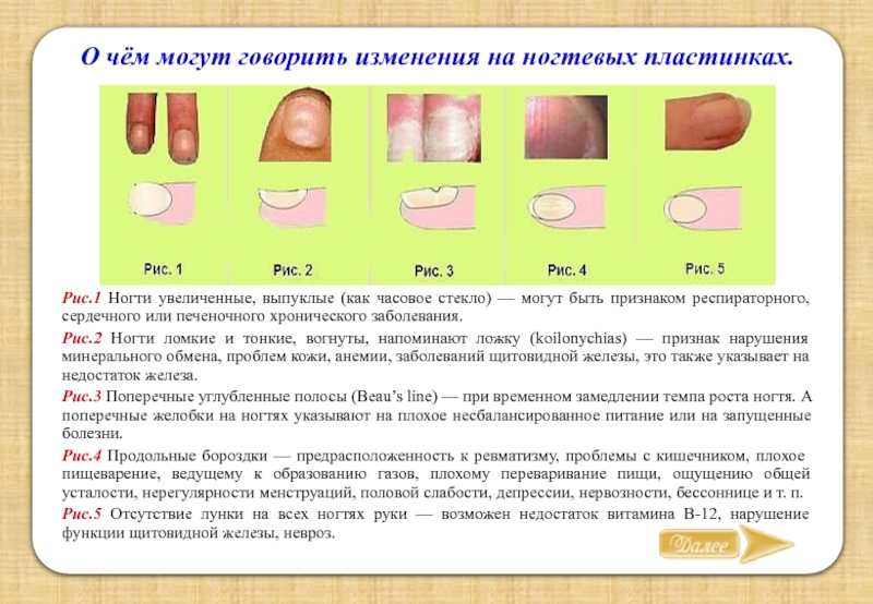 По ногтям определить болезнь человека на руках фото начальная