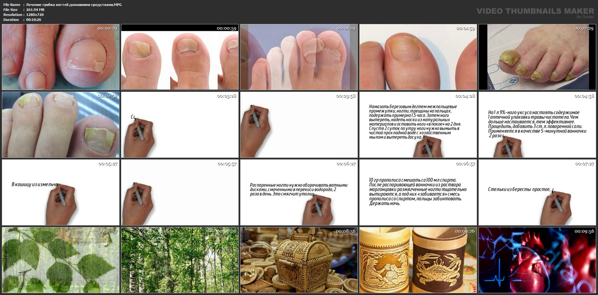 Как лечить грибок ногтей народными средствами