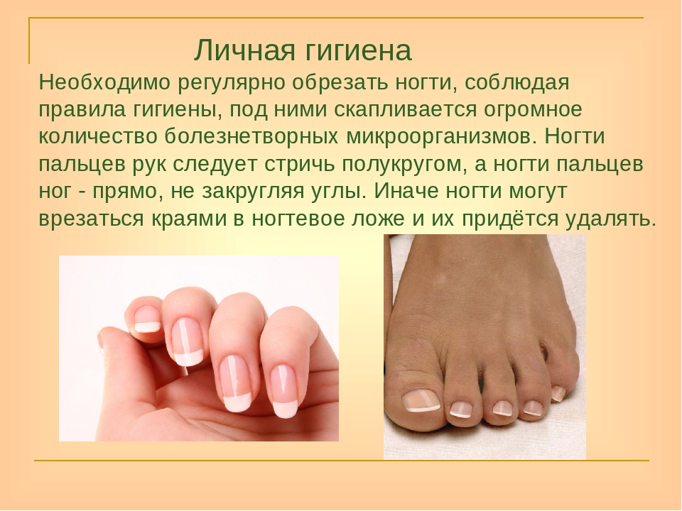 Как исправить горбатые ногти