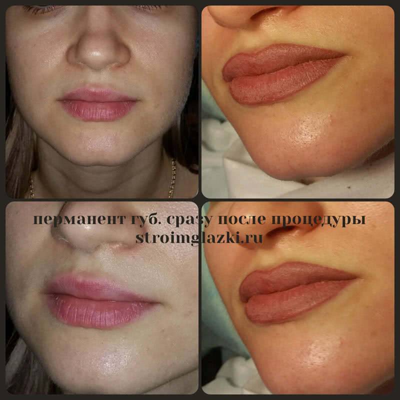 Фото до и после нанесения перманентного макияжа губ
