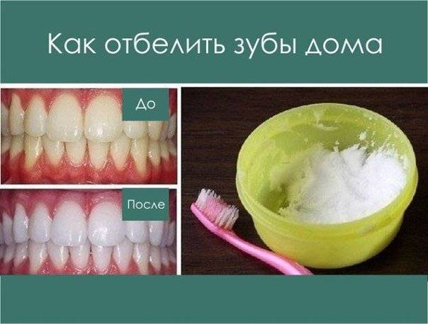 Безопасное отбеливание зубов