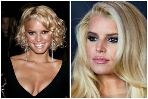 Как выглядели эти поп-звезды до и после пластической операции | кино новости