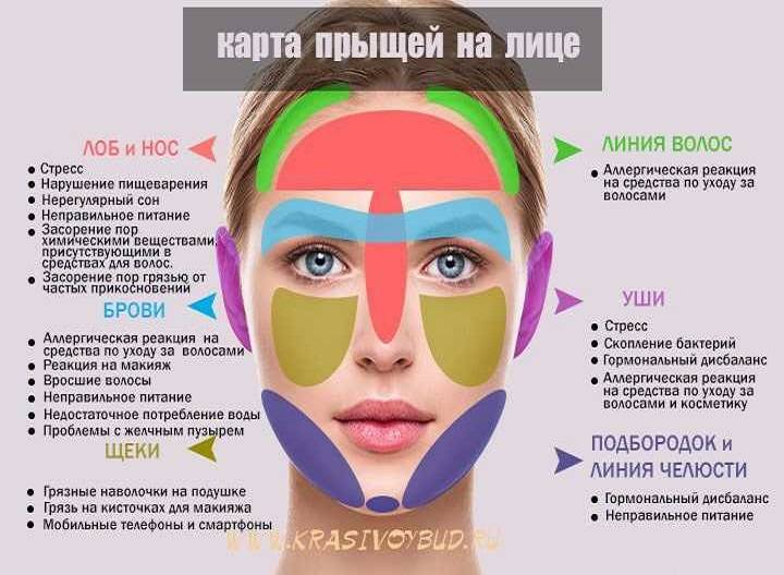 Просянка (белые угри, милиумы) – причины появления, лечение, профилактика