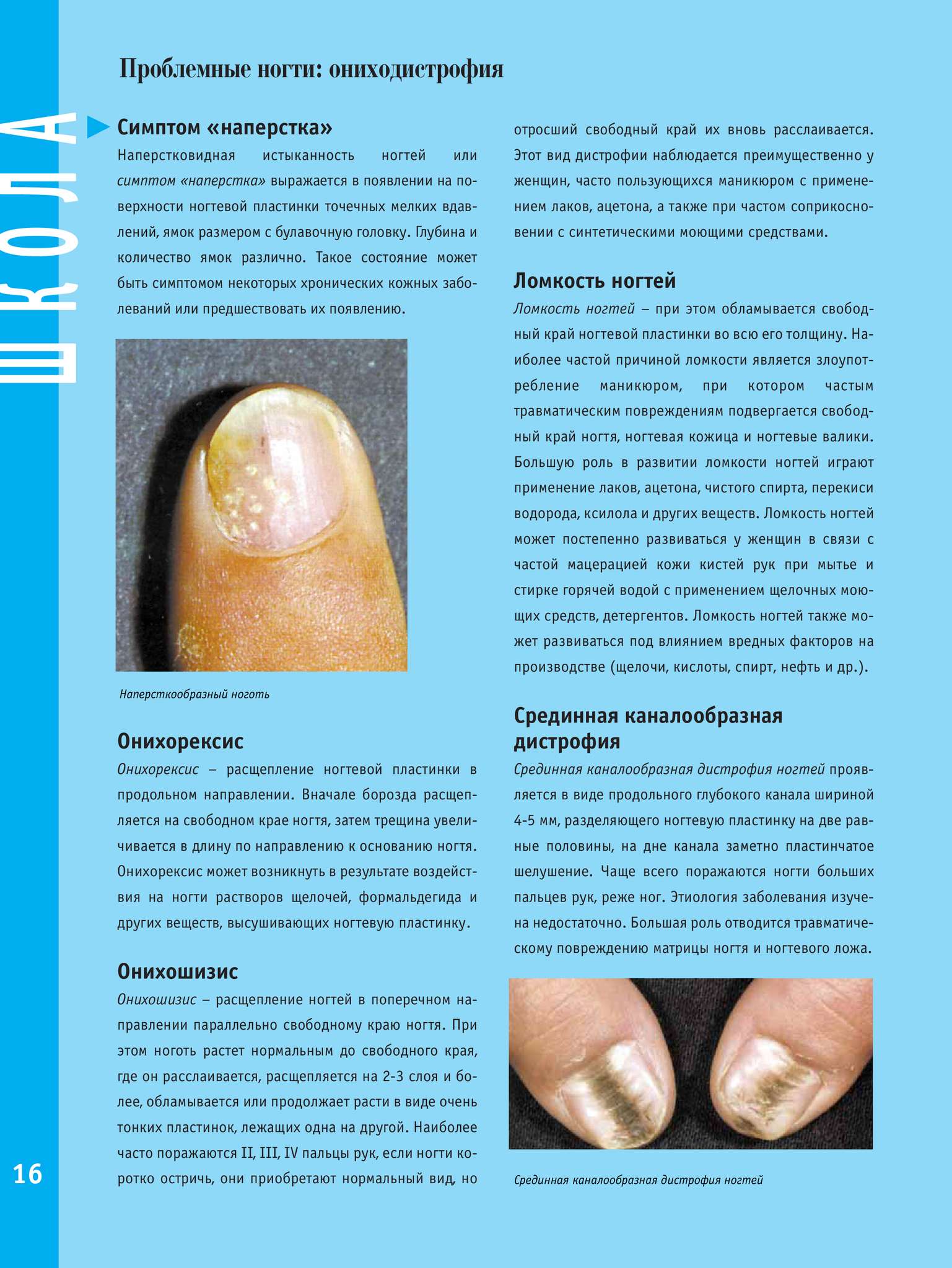 Заболевания и травмы ногтей – какие они бывают и почему появляются. !