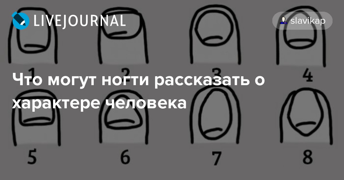 О чем говорит форма ногтей. Ногти человека и характер. Характер человека по ногтям. Форма ногтей расскажет о характере. Характер по форме маникюра.