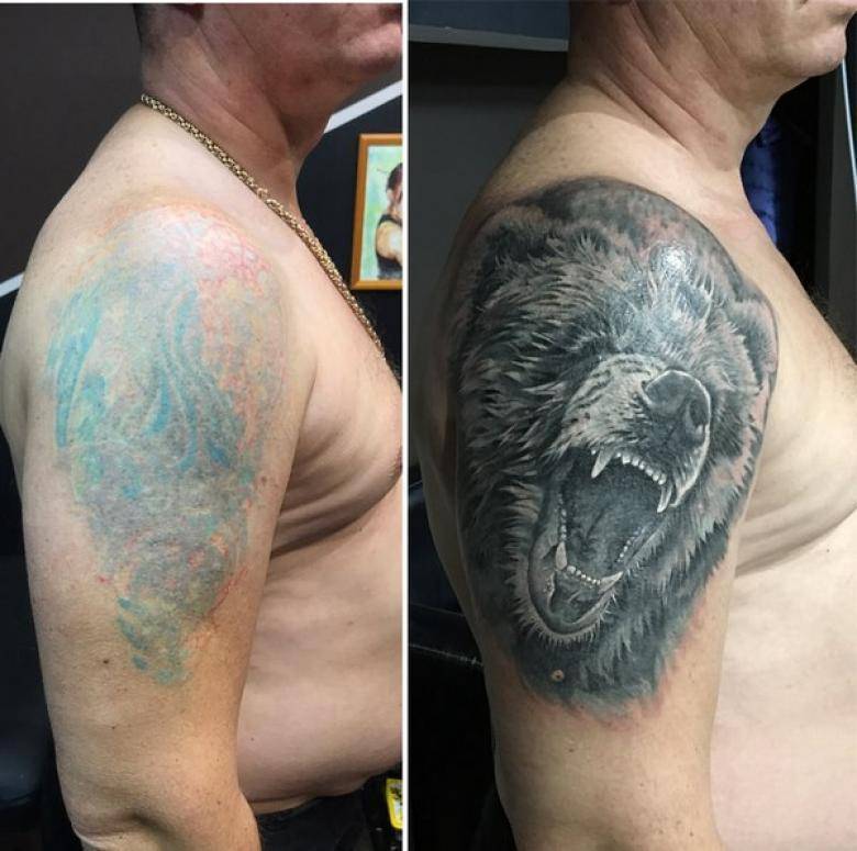 Коррекция тату - техника работы с кожей, позволяющая устранить...