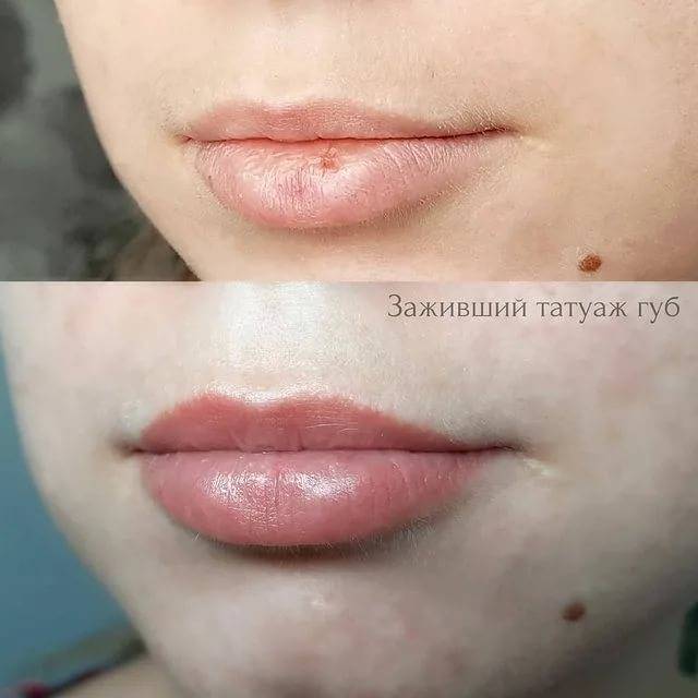 Перманентный макияж: коррекция синих губ