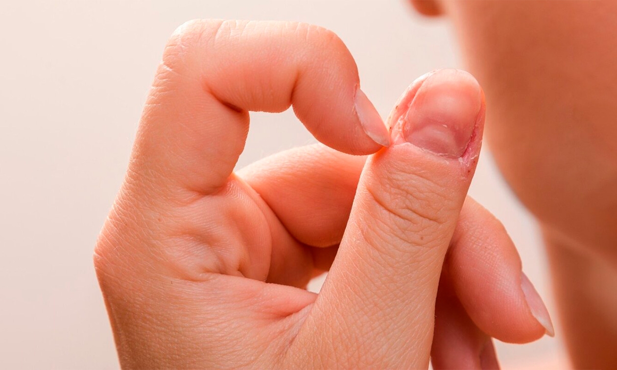 Заусенцы на пальцах: причины и лечение, фото