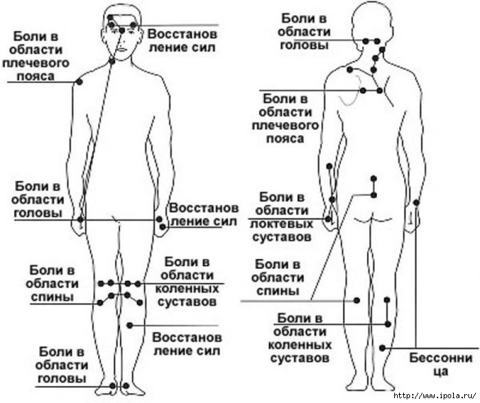 Иглоукалывание точки на теле схема и что