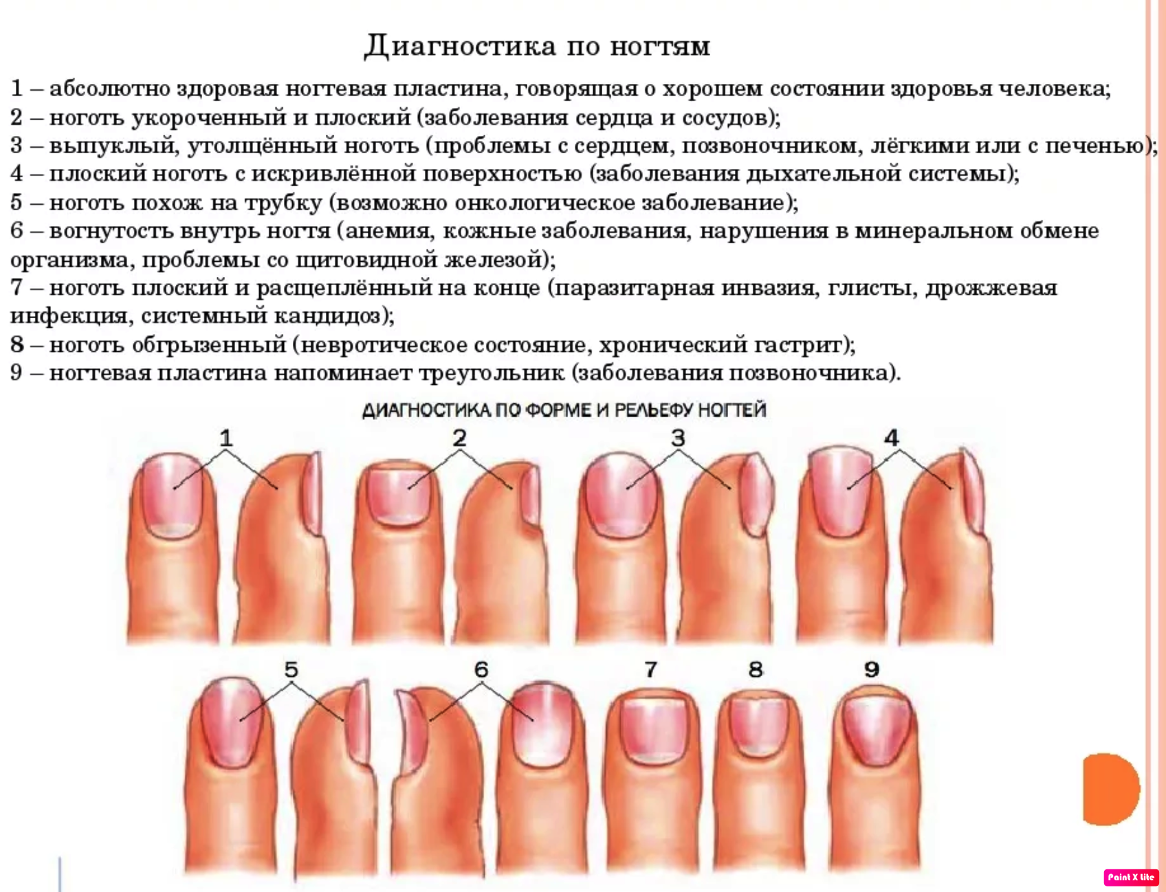 Почему истончаются ногти и что делать в таких случаях - сайт о ногтях