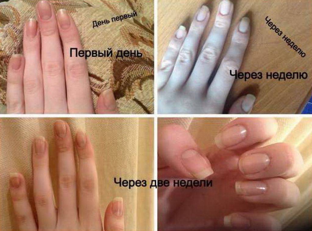 Как ускорить рост ногтей на руках в домашних условиях
как ускорить рост ногтей на руках — модная дама