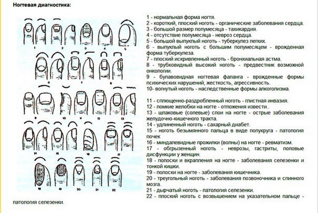 Заболевания ногтей на руках таблица описание и картинки онихолизис лечение