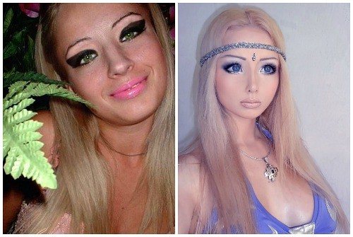 Валерия лукьянова- русская барби до и после пластических операций