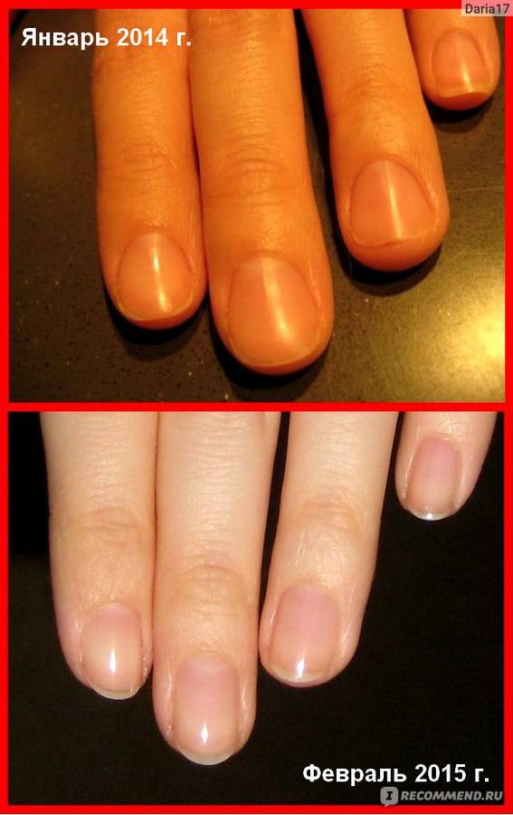 Как производится удлинение ногтевого ложе пальцы рук и ног | beauty-love.ru
