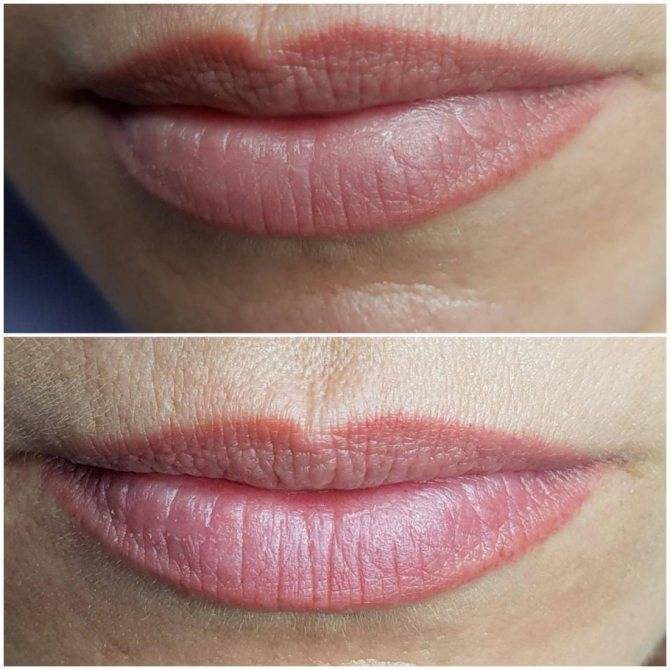 Татуаж губ — фото поэтапного заживление перманентного макияжа