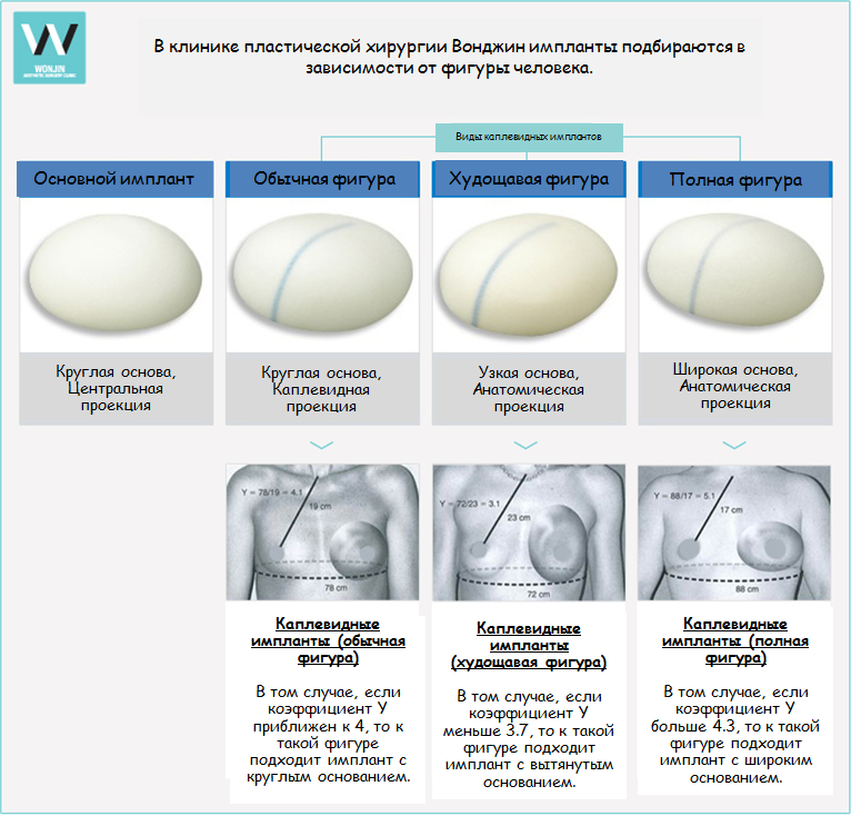 Грудные импланты виды и размеры фото