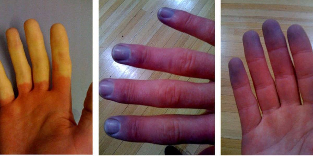 Проблемы со здоровьем, о которых предупреждают лунки на ногтях -отделение профилактики