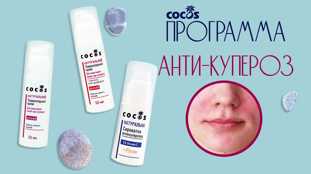 Косметология, светолечение, чистка лица, массаж, озонотерапия, фотолечение, мезотерапия, фототерапия диета, витамины и химический пилинг при куперозе – вред или польза?
