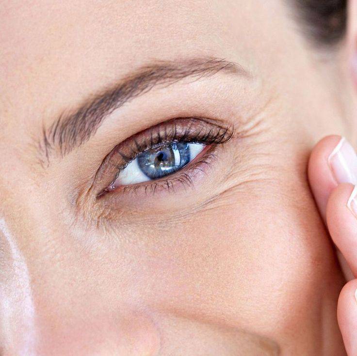 Как убрать морщины вокруг глаз - центр эстетической медицины
