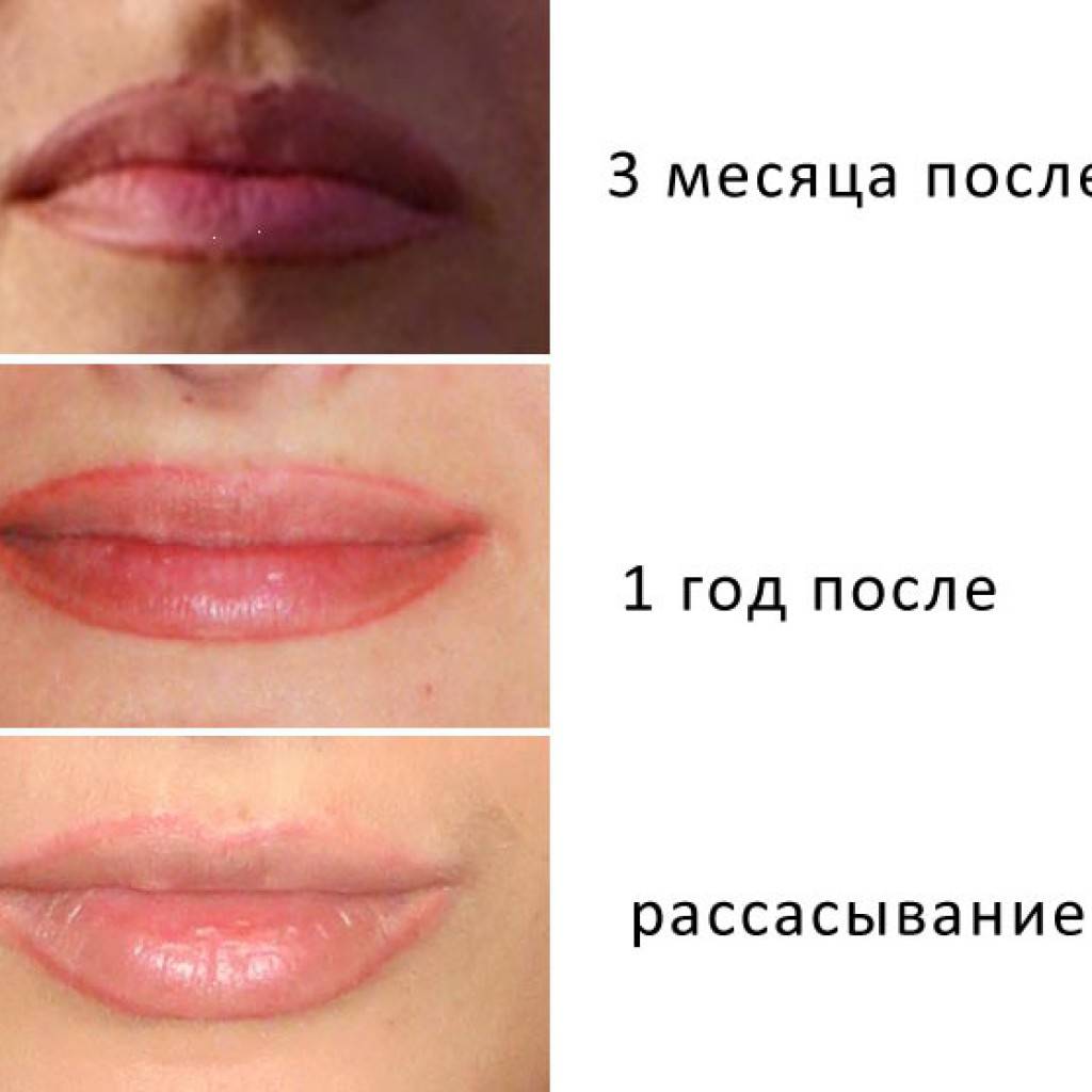 Перманентный макияж губ: виды, отзывы косметологов, фото татуажа до процедуры и после заживления | ddick.ru