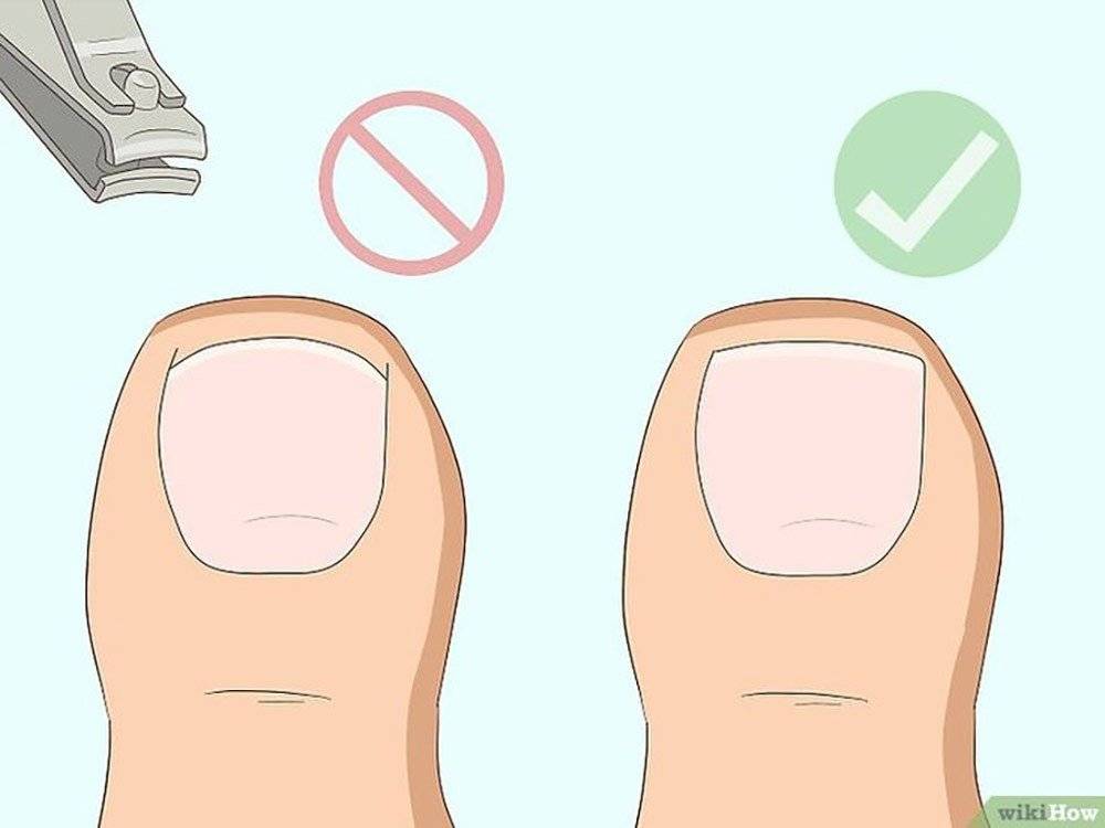 Как правильно стричь ногти на ногах в домашних условиях ребенку и взрослому