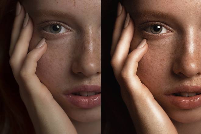 Fotona 4d - лазерная технология омоложения и подтяжки кожи лица | клиника нео вита