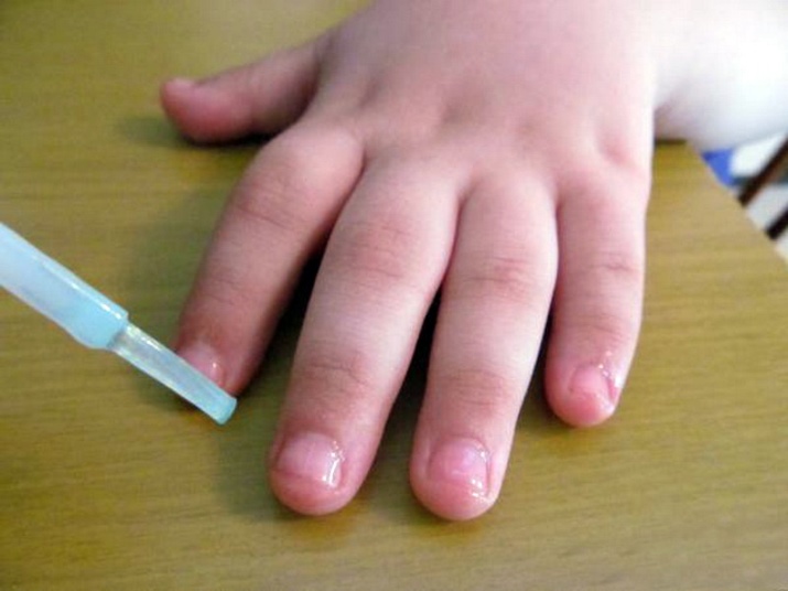 Как перестать грызть ногти раз и навсегда: 10 проверенных способов