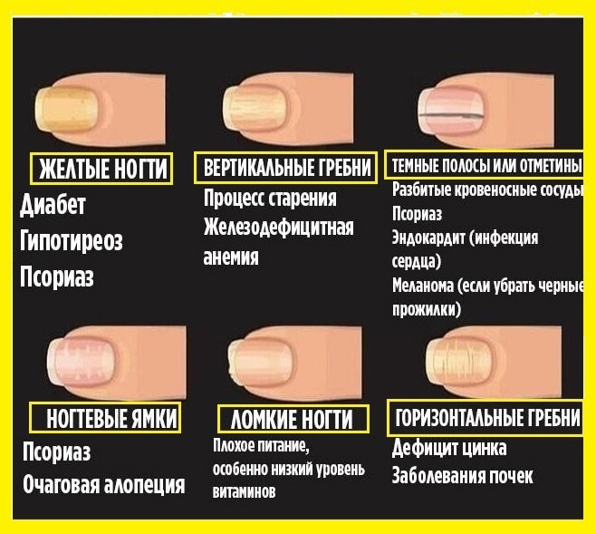 Ногти — большая медицинская энциклопедия