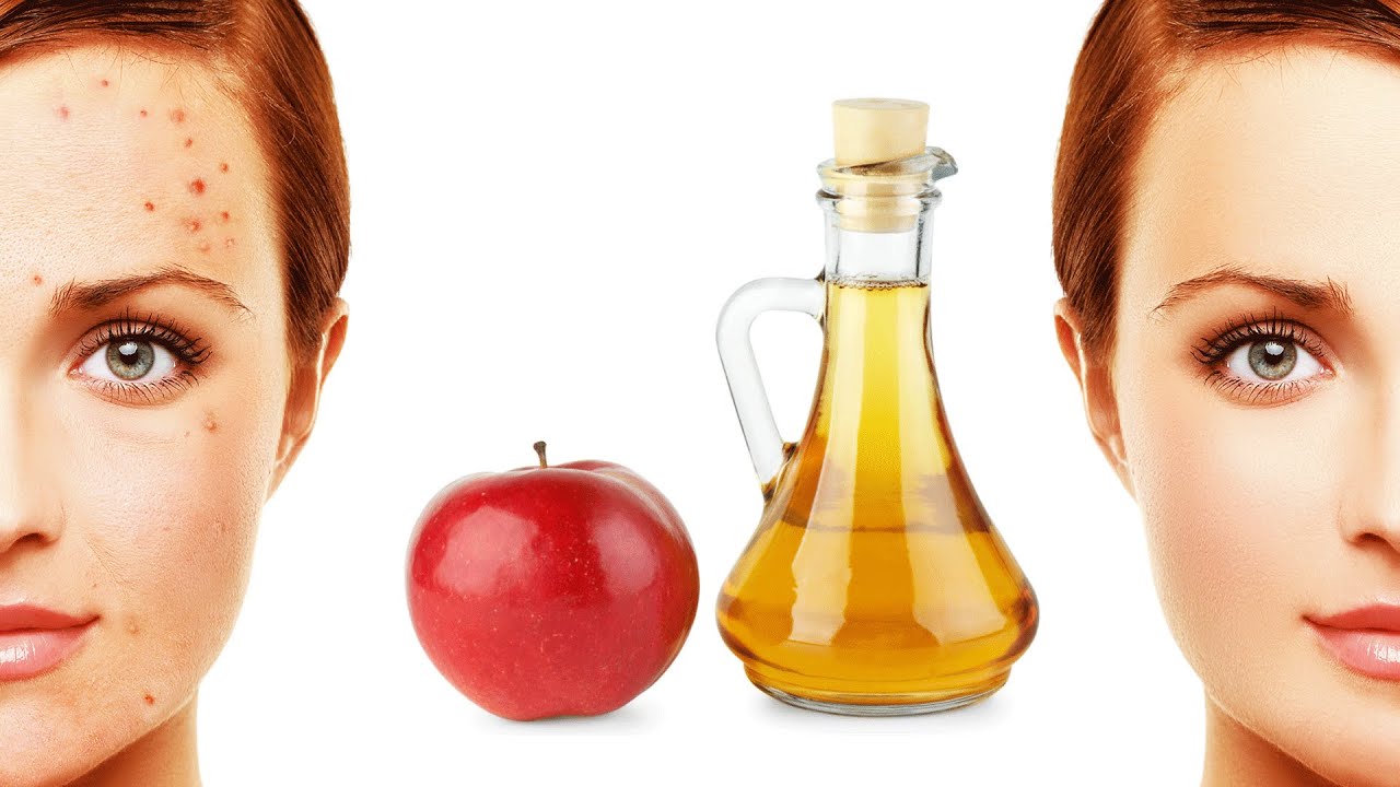 Чем полезен яблочный уксус для кожи лица, отзывы и рецепты