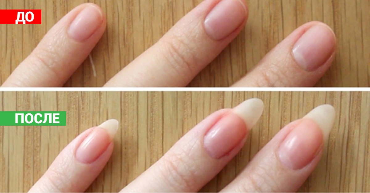 Как быстро растут ногти на руках и от чего это зависит? | красивые ногти - дополнение твоего образа