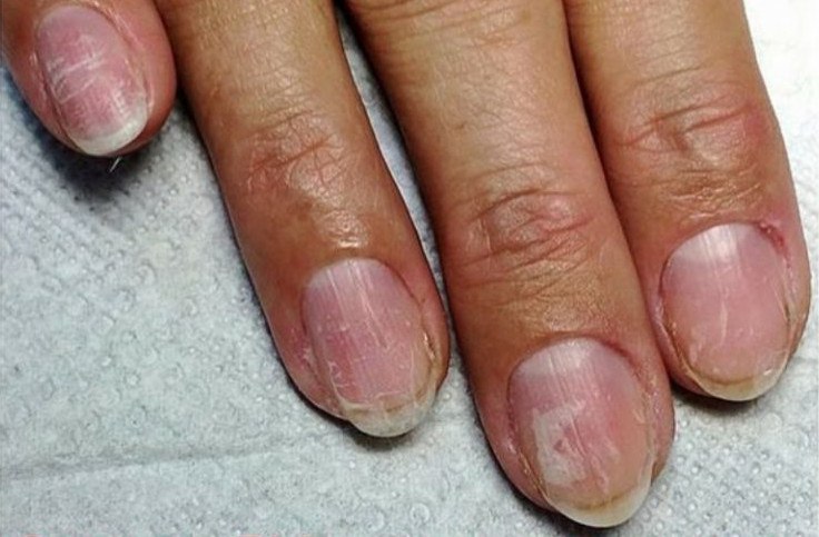 Чем опасен гель-лак для ногтей: научное исследование