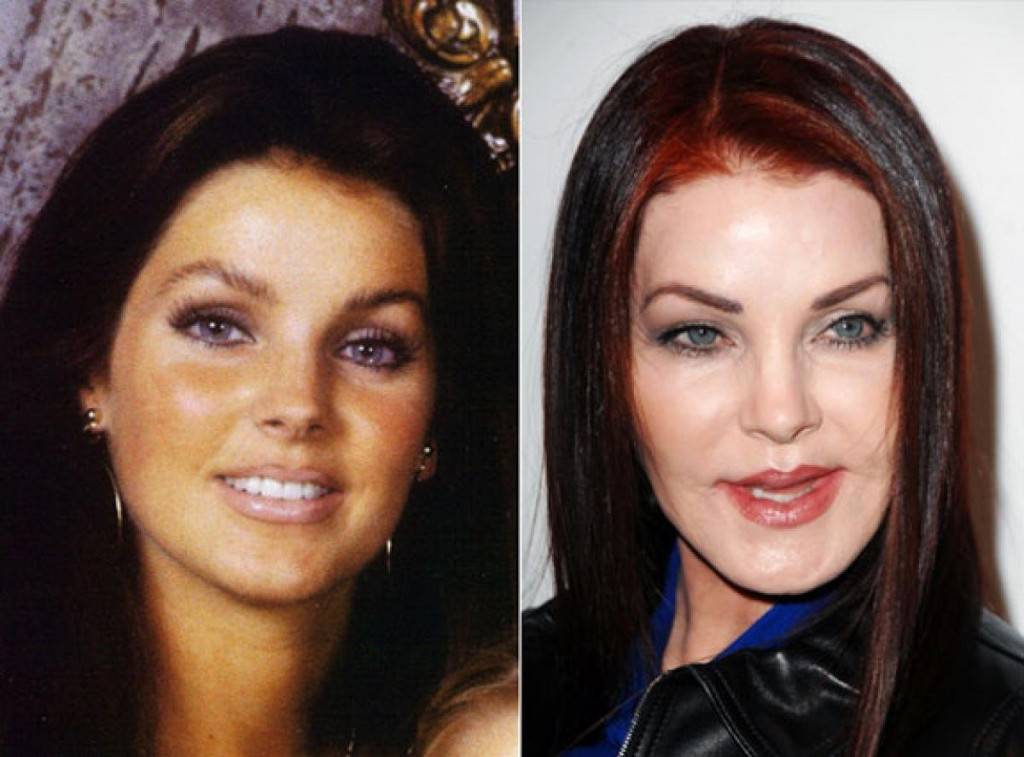 Анджелина джоли до и после пластических операций – фото и версии экспертов