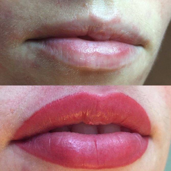 Перманентный макияж губ: фото до и после, техники, отзывы, заживление, уход, коррекция и удаление