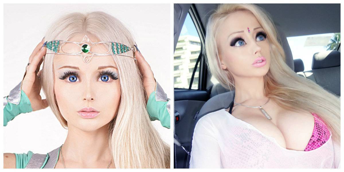 Барби пластика фото до и после у женщин